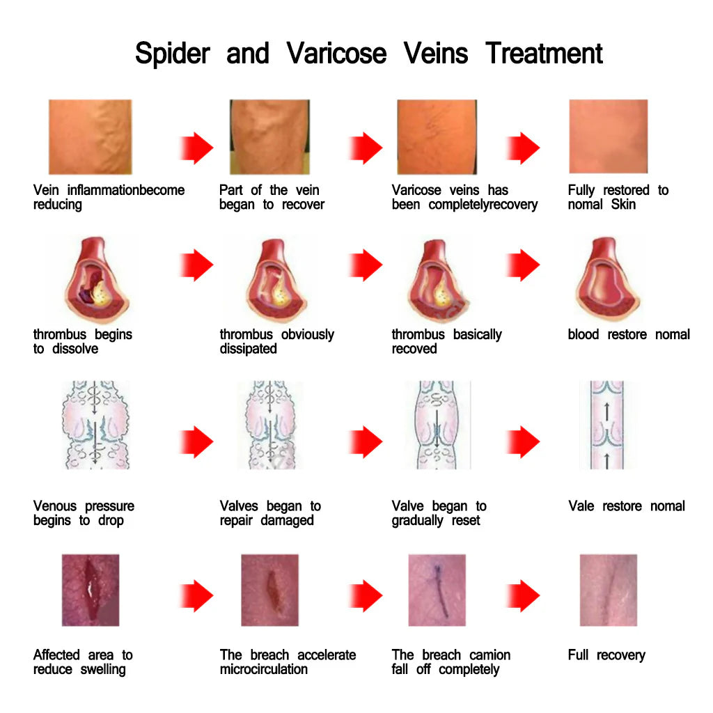 Vein Care Lotion for Nurses