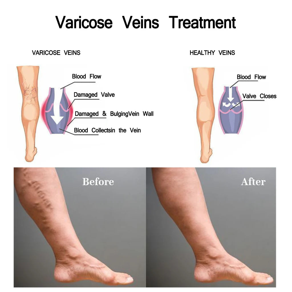 Vein Care Lotion for Nurses